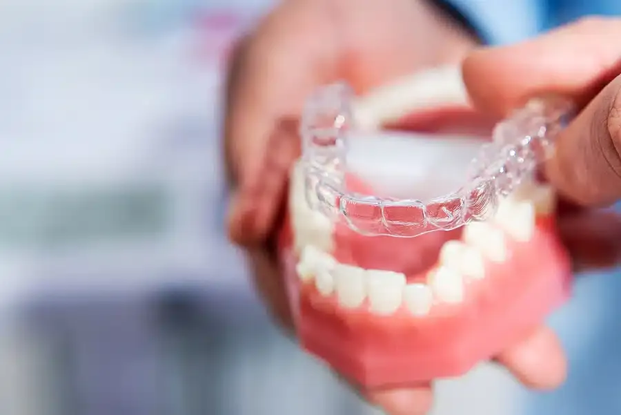 Invisalign-style aligner fitted on a dental model