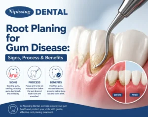 Root Planing