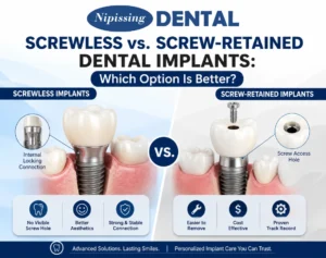 what are screwless dental implants