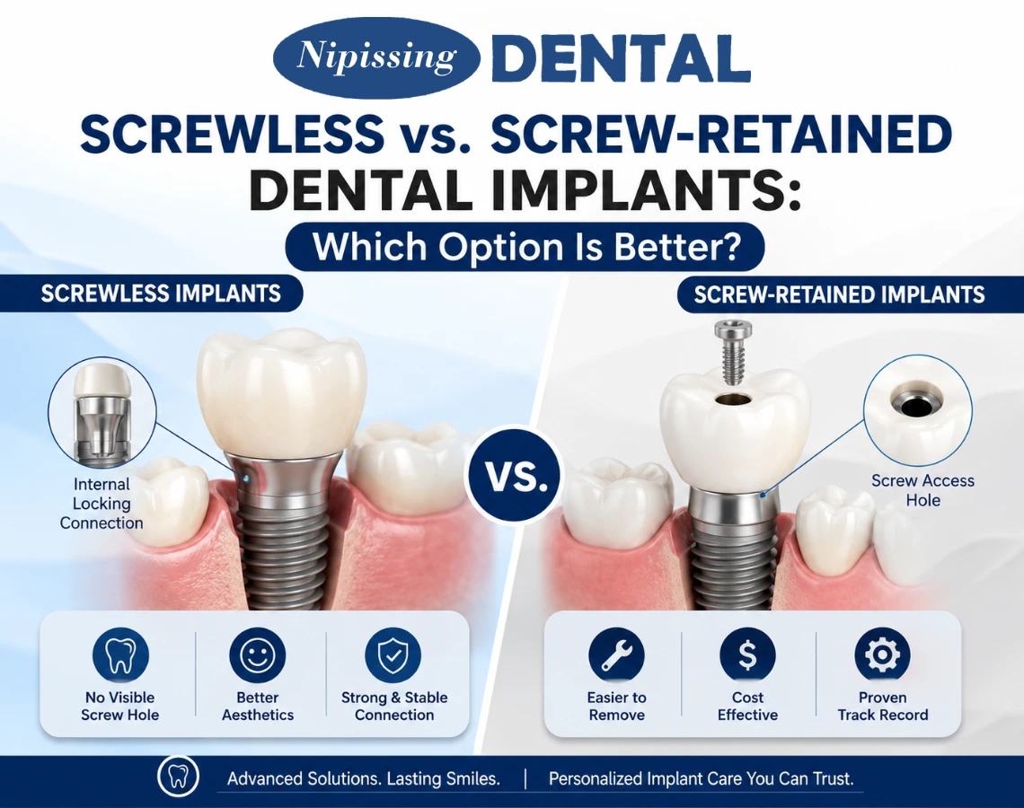 what are screwless dental implants