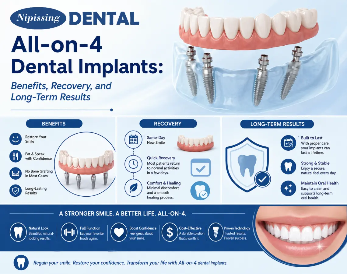 all on 4 dental implants