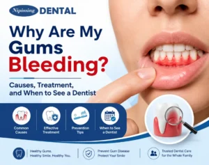 bleeding gums
